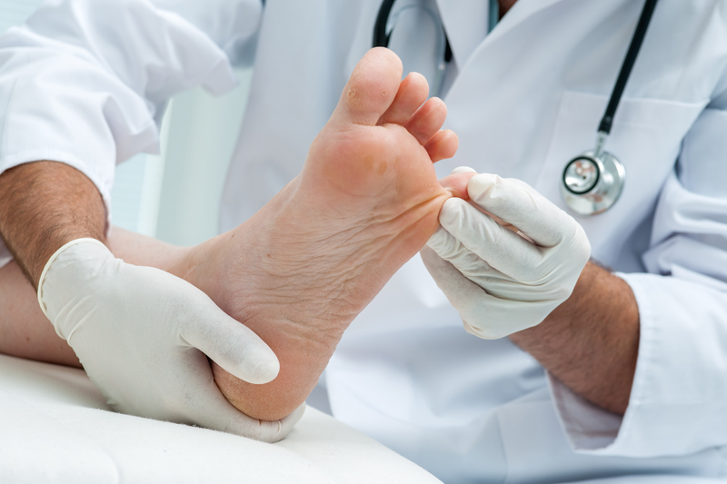 Doctor Dermatologist Examines The Foot On The Presence Of Athletes Foot